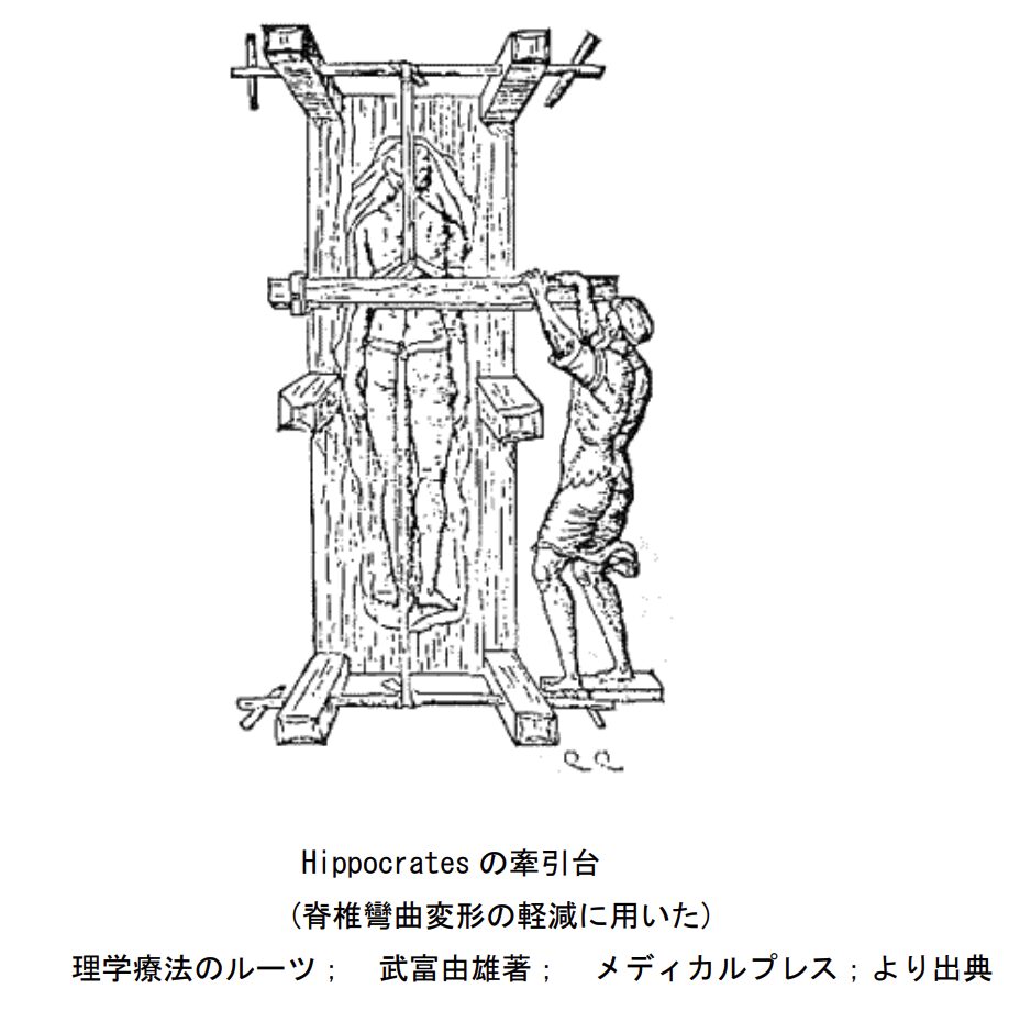 ヒポクラテスの牽引台